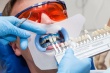 Профессиональное отбеливание зубов: показания, противопоказания, методики