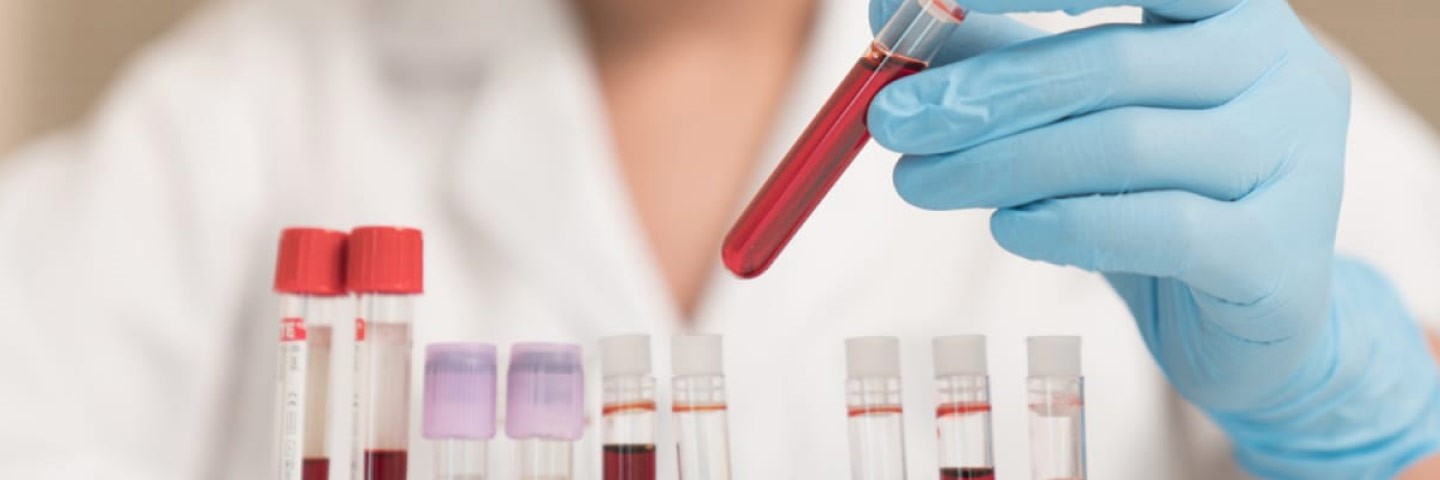 Анализы крови: какие бывают и как правильно к ним готовиться 